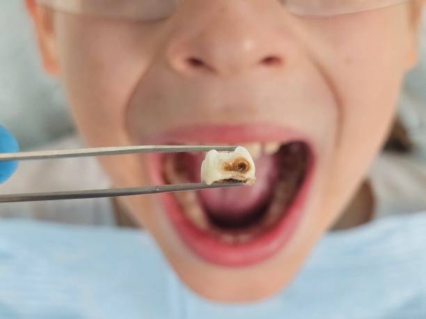 Emergency Dentist for Kids in FL